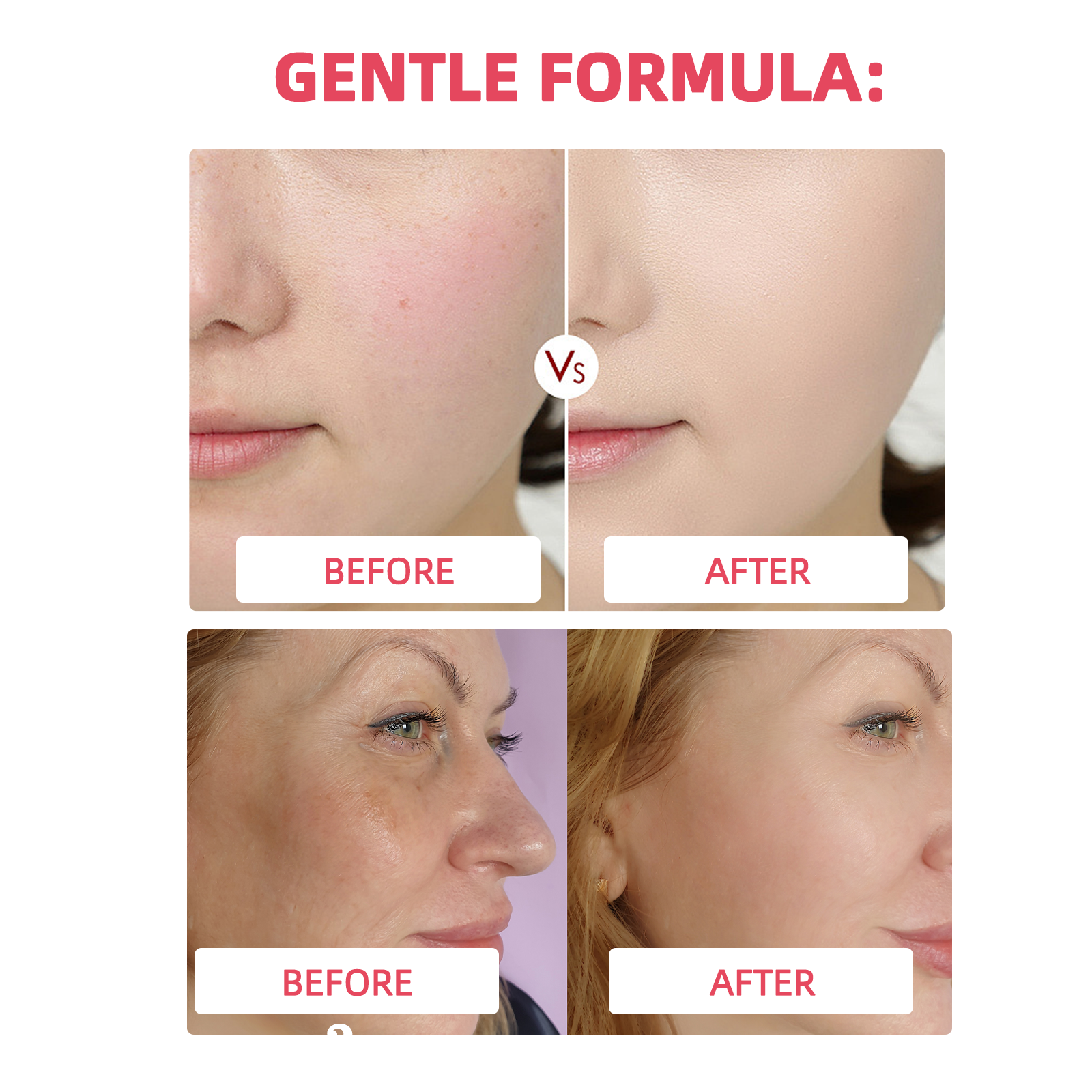 PDRN Collagen Jelly Cream Anti - مراجعة Crossfit Lifting وسعره